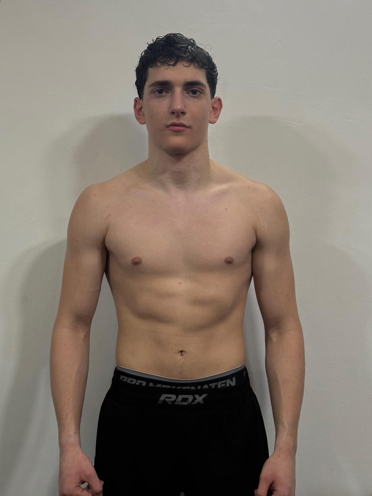 Anil DENIZ
